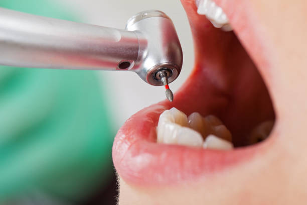 Best Tooth Infection Emergency Dentist  in Delmont, PA